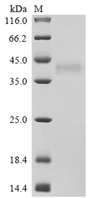 Recombinant Human Tumor necrosis factor receptor superfamily member 17 (TNFRSF17), partial, Biotinylated (CSB-MP023974HU1-B)