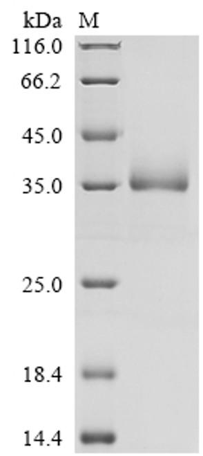 Recombinant Human Vesicular integral-membrane protein VIP36 (LMAN2), partial (CSB-MP619640HU)