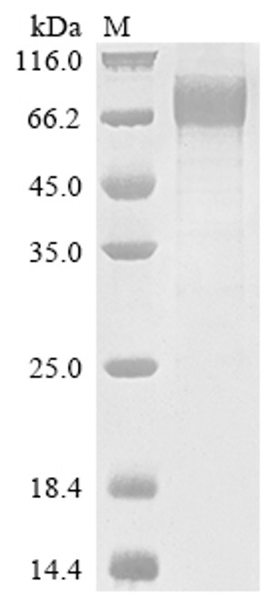 Recombinant Human Interleukin-10 receptor subunit alpha (IL10RA), partial (CSB-MP621688HU)