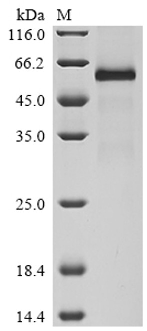 Recombinant Human Tumor necrosis factor receptor superfamily member 11A (TNFRSF11A), partial (CSB-MP896933HU)