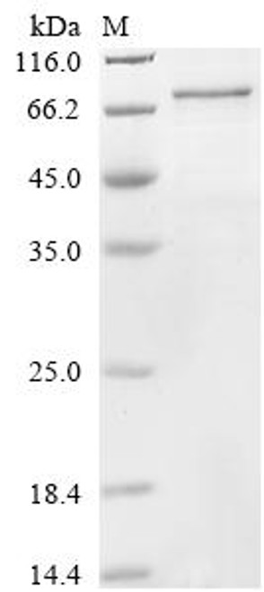 Recombinant Human Cysteine-rich secretory protein LCCL domain-containing 1 (CRISPLD1) (CSB-CF884457HU)