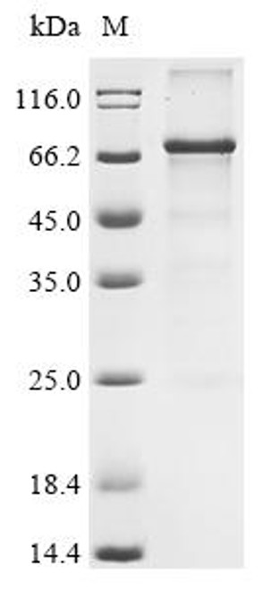 Recombinant Human Cysteine-rich secretory protein LCCL domain-containing 1 (CRISPLD1) (R431H) (CSB-CF884457HU(M1))