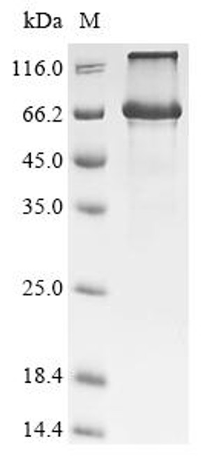 Recombinant Human Cysteine-rich secretory protein LCCL domain-containing 1 (CRISPLD1) (G371D) (CSB-CF884457HU(M))