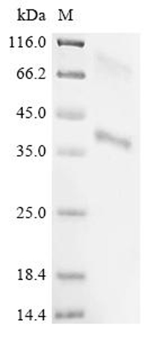Recombinant Hepatitis B virus genotype D subtype ayw Large envelope protein (S) (CSB-CF365858HEM)