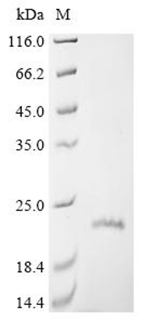 Recombinant Human Claudin-1 (CLDN1) (CSB-CF005490HU)
