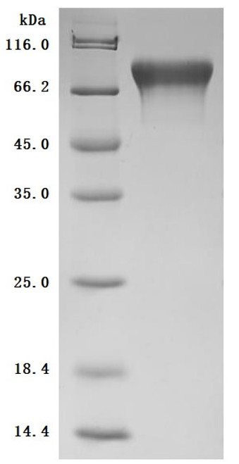 Recombinant Mouse Cell adhesion molecule 1 (Cadm1), partial (Active) (CSB-MP004425MO)