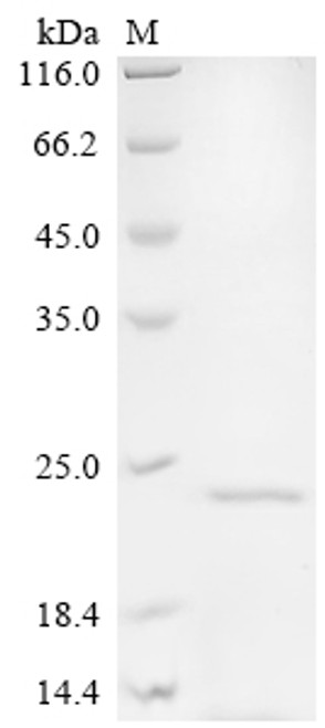 Recombinant Mycobacterium intracellulare Lipoprotein lpqH (lpqH) (CSB-EP333609MVM)