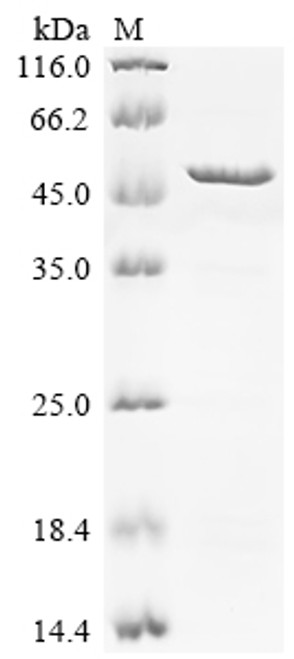 Recombinant Human Melanoma-associated antigen 8 (MAGEA8) (CSB-EP013334HU)