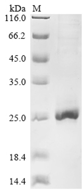 Recombinant Rat Troponin I, fast skeletal muscle (Tnni2) (CSB-EP333290RA)