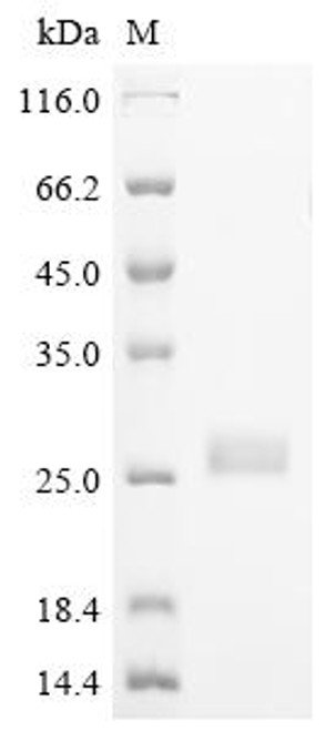 Recombinant Human TGF-beta receptor type-2 (TGFBR2), partial (CSB-EP023452HU1)