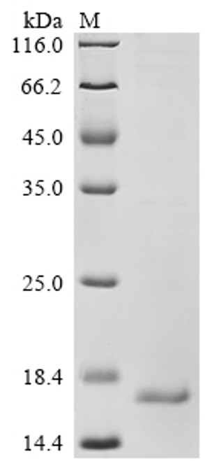 Recombinant Human Augurin (ECRG4), partial (CSB-EP887957HU)