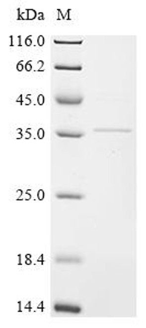 Recombinant Rat Troponin T, cardiac muscle (Tnnt2) (CSB-EP341903RAe1)