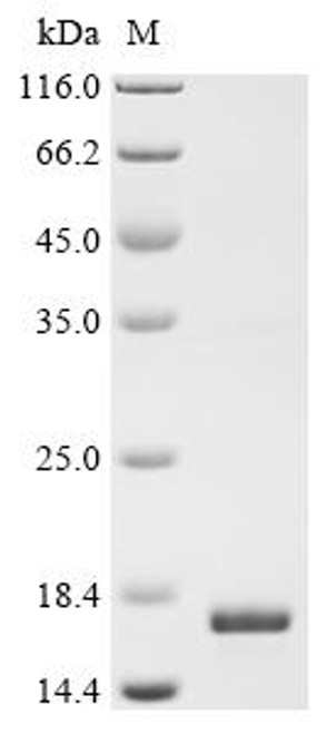 Recombinant Pig Proenkephalin-B (PDYN), partial (CSB-EP017750PI)