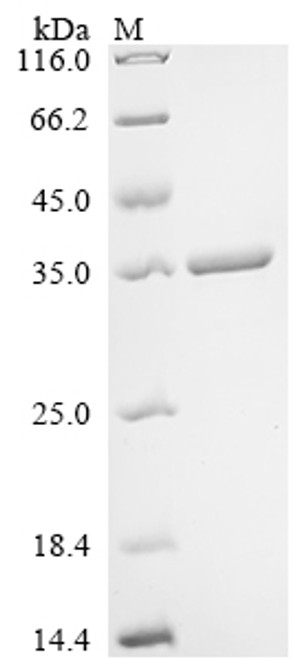 Recombinant Penicillium citrinum Nuclease P1 (CSB-EP328459PEUb1)