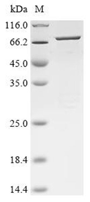 Recombinant Human Transient receptor potential cation channel subfamily M member 1 (TRPM1), partial (CSB-EP773791HU)