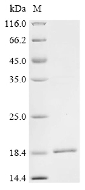 Recombinant Sendai virus Fusion glycoprotein F0 (F), partial (CSB-EP361388SFB)