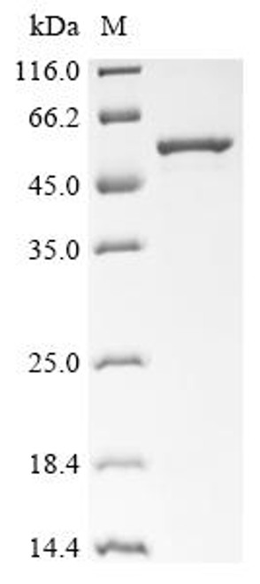Recombinant Human Melanoma-associated antigen B1 (MAGEB1) (CSB-EP013337HU)