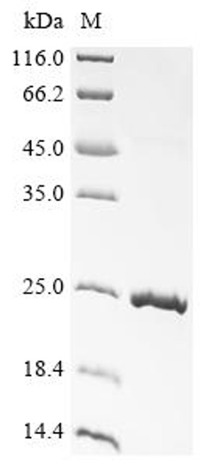 Recombinant Sheep Growth/differentiation factor 9 (GDF9) (CSB-EP009352SH)