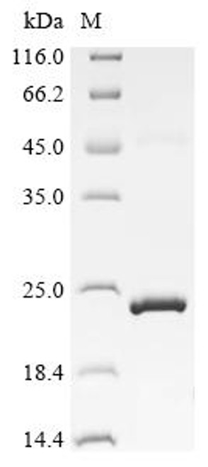 Recombinant Sheep Bone morphogenetic protein 15 (BMP15) (CSB-EP002735SH)