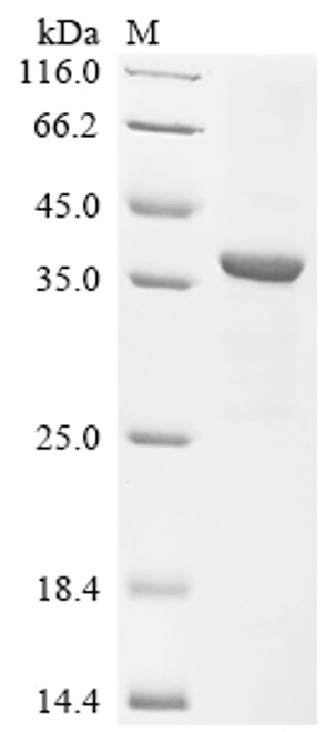Recombinant Human respiratory syncytial virus A Major surface glycoprotein G (G), partial, Biotinylated (CSB-EP365937HPOm4-B)