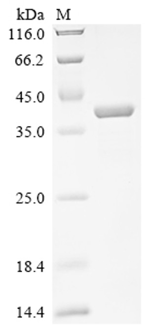 Recombinant Human Endoplasmic reticulum metallopeptidase 1 (ERMP1), partial (CSB-EP007794HU)