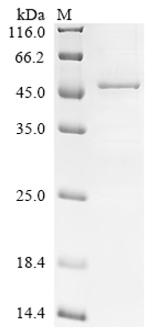 Recombinant Human Acetyl-CoA acetyltransferase,mitochondrial (ACAT1) (CSB-EP001134HUc7)