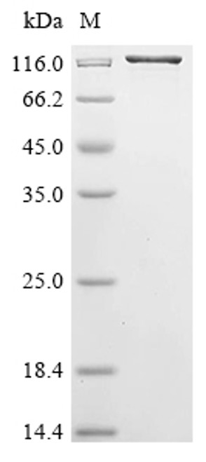 Recombinant Aquifex aeolicus DNA mismatch repair protein MutS (mutS), Biotinylated (CSB-EP524095DNV-B)