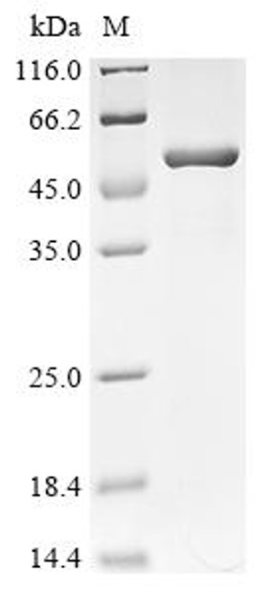 Recombinant Human Succinyl-CoA ligase [ADP-forming] subunit beta, mitochondrial (SUCLA2) (CSB-EP868398HU)