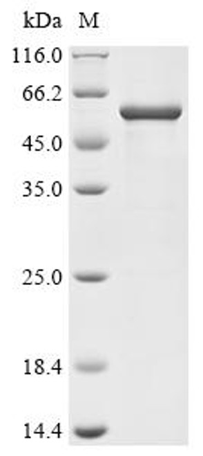 Recombinant Human Nuclear factor NF-kappa-B p105 subunit (NFKB1), partial (CSB-EP015759HU1)