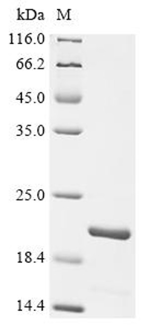 Recombinant Human Aquaporin-5 (AQP5), partial (CSB-EP001965HU1)