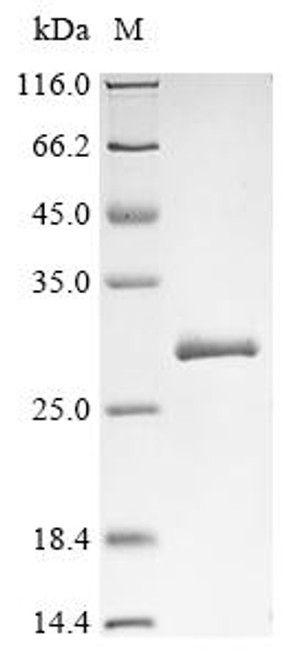 Recombinant Helicobacter pylori LPP20 lipoprotein (lpp20) (CSB-EP362991HCQ)