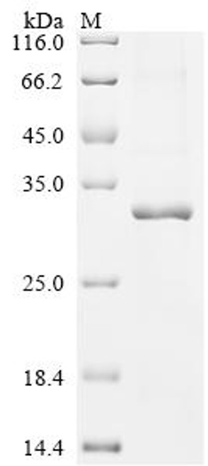 Recombinant Human Ras-related and estrogen-regulated growth inhibitor-like protein (RERGL) (CSB-EP884475HU)