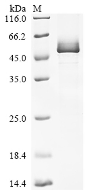 Recombinant Human Lipoyl synthase, mitochondrial (LIAS) (CSB-EP012927HUc7)