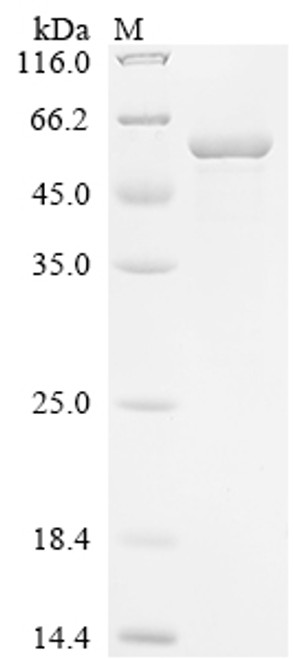 Recombinant Human Kinesin-1 heavy chain (KIF5B), partial (CSB-EP012342HU2)