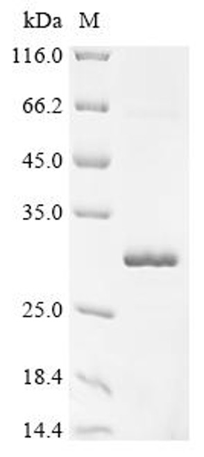 Recombinant Monkeypox virus Cu-Zn superoxide dismutase-like protein (A46R) (CSB-EP844975MHV)