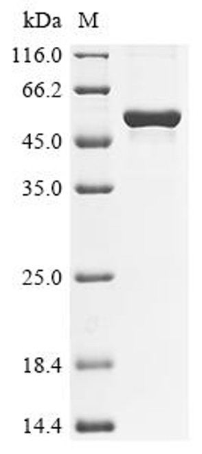 Recombinant Mouse Angiopoietin-related protein 3 (Angptl3) (CSB-EP874172MO)