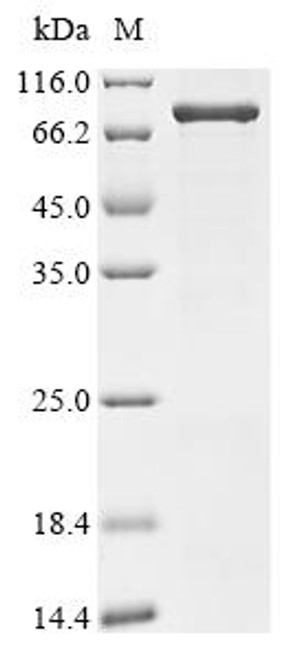 Recombinant Human Junctional protein associated with coronary artery disease (JCAD), partial (CSB-EP873729HU)