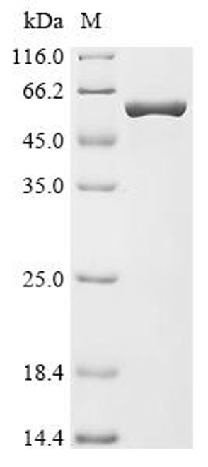 Recombinant Escherichia coli O157:H7 Multicopper oxidase CueO (cueO) (CSB-EP855560EOD)