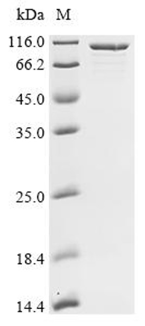 Recombinant Clostridium tetani Tetanus toxin (tetX), partial (CSB-EP356416CMN2)