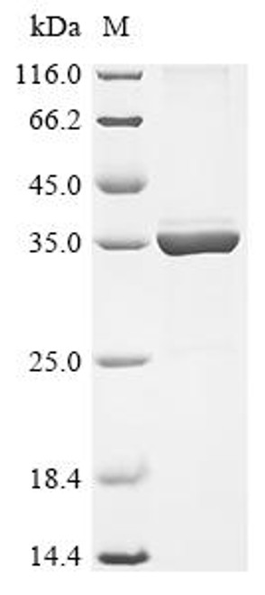Recombinant Rhizobium meliloti Nodulation protein H (nodH) (CSB-EP356754RKT)