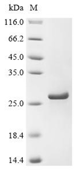 Recombinant Pleurotus ostreatus Ostreolysin (OlyA6) (CSB-EP306885EXB)