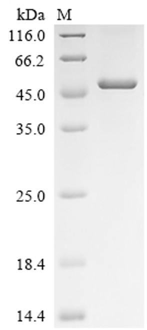 Recombinant Xenopus laevis Decapping and exoribonuclease protein (dxo) (CSB-EP683277XBE)
