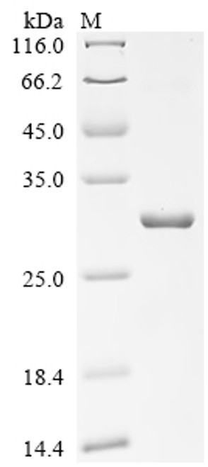 Recombinant Mouse Tolloid-like protein 2 (Tll2), partial (CSB-EP895308MOb1)