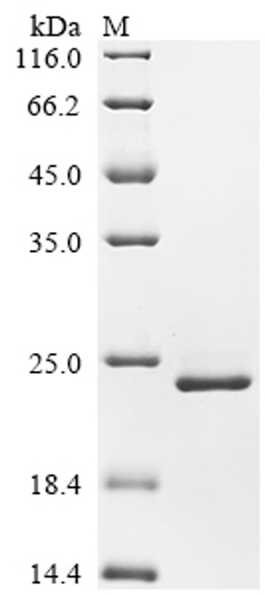 Recombinant Human Metal cation symporter ZIP14 (SLC39A14), partial (CSB-EP617996HU1)