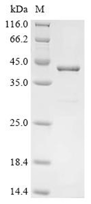 Recombinant Vaccinia virus Pseudokinase OPG198 (B12) (CSB-EP321889VAA)