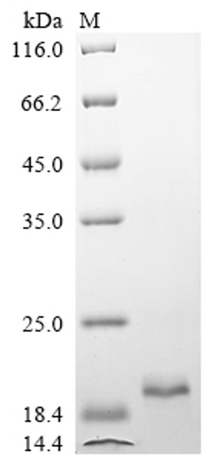 Recombinant Chicken Fibroblast growth factor 2 (FGF2) (CSB-EP008625CHb0)