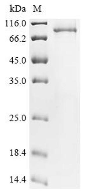 Recombinant Human Mitofusin-2 (MFN2) (CSB-CF013756HU)
