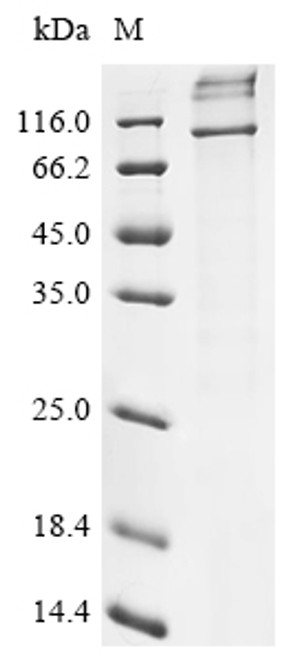 Recombinant Human E3 ubiquitin-protein ligase AMFR (AMFR) (CSB-CF892337HU)
