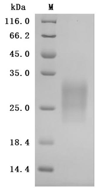 Recombinant Rat Gastric inhibitory polypeptide receptor (Gipr), partial (Active) (CSB-MP009438RA1)