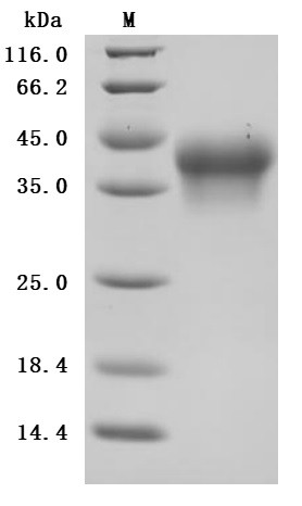 Recombinant Human Interleukin-2 receptor subunit alpha (IL2RA), partial (Active) (CSB-MP011649HU3)